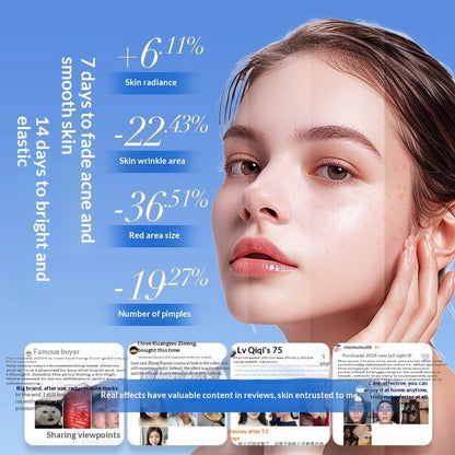Silicone LED Therapy Mask – Facial Rejuvenation and Acne Control