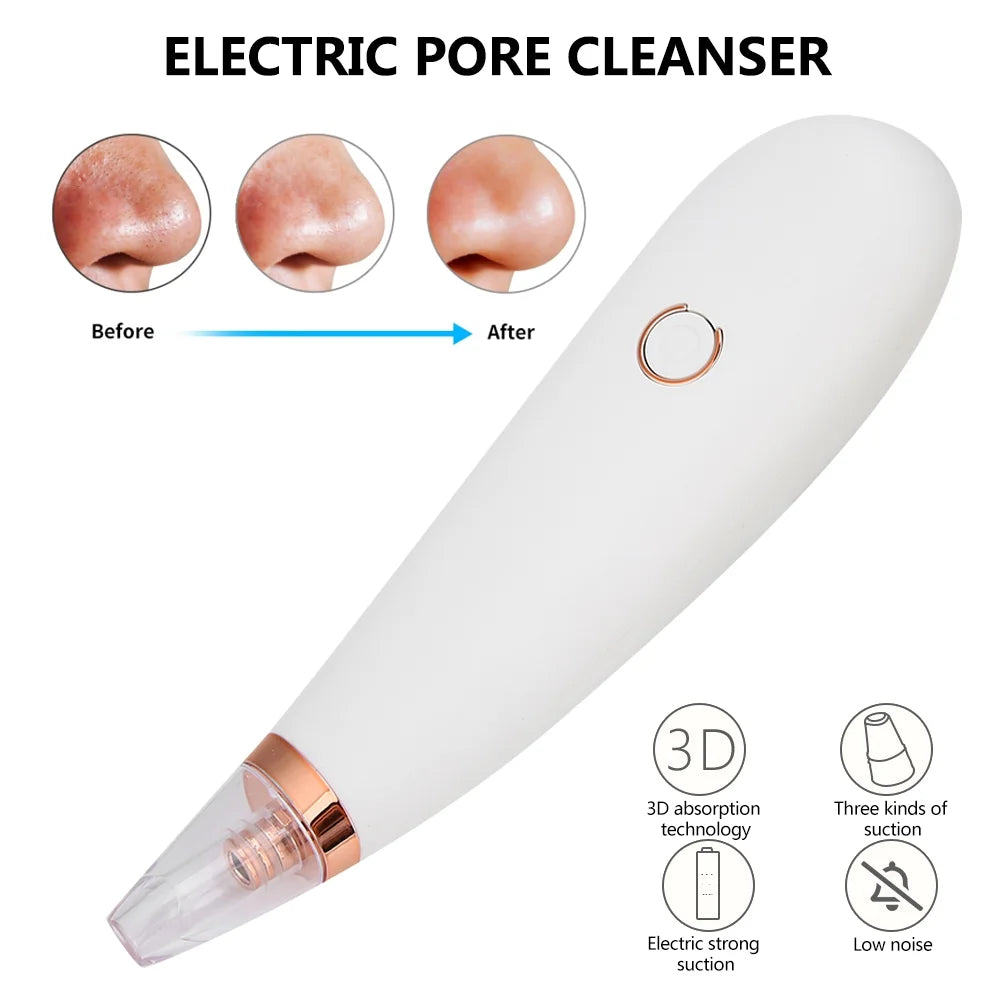 Extractor de Poros M-2005 – Limpieza Facial Profunda con 4 Boquillas Especializadas