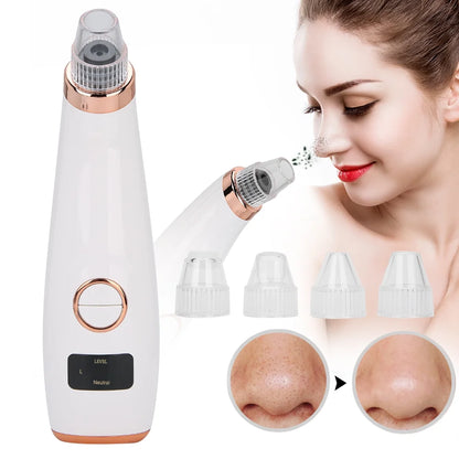 Extractor de Poros M-2005 – Limpieza Facial Profunda con 4 Boquillas Especializadas