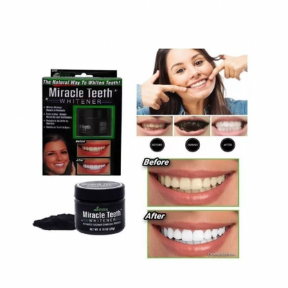 Blanqueador de Dientes en Polvo – Sonríe con Confianza
