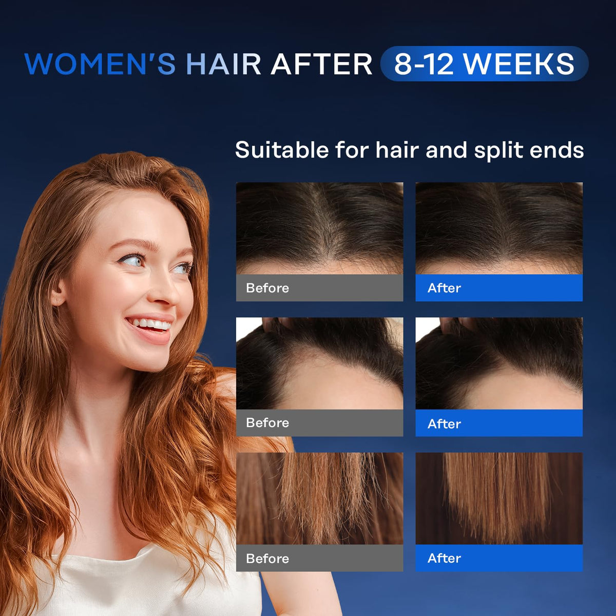 Serum Crece-Pelo Intenso – ¡Recupera tu Cabello y Barba con Minoxidil y Biotina!