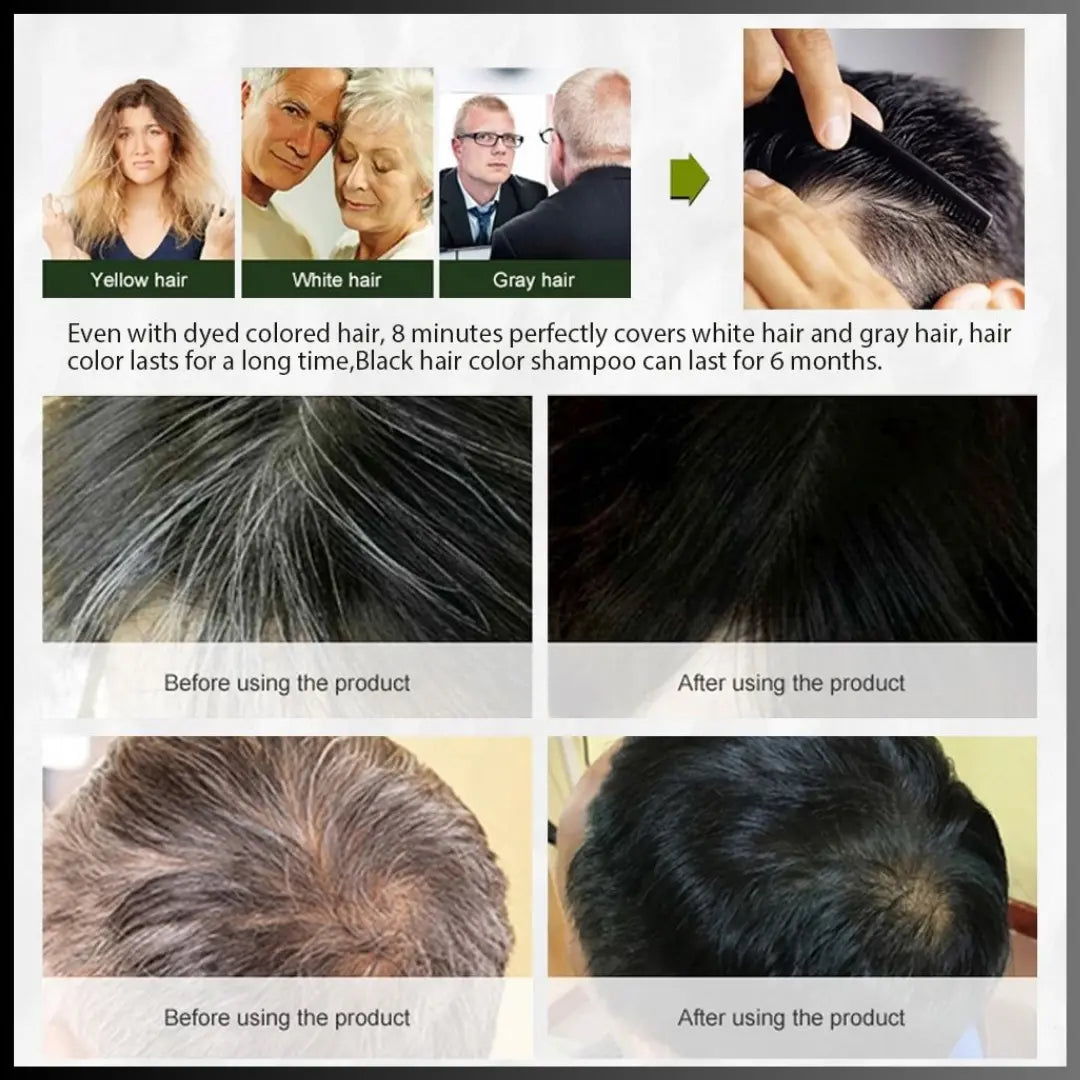 Shampoo Black Hair Anti-Canas