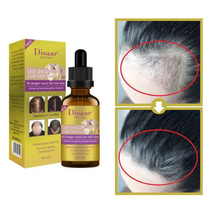 Ginger Serum Anti-Hair Loss – Natural Growth Stimulant 