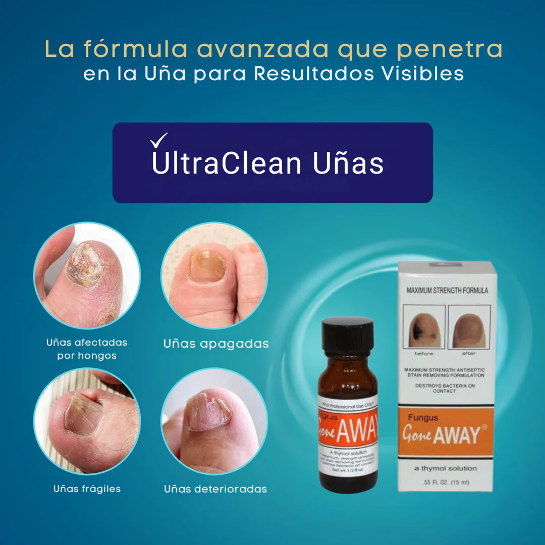 Tratamiento Antifúngico Pro – ¡Recupera la Salud y Belleza de tus Uñas Ya!
