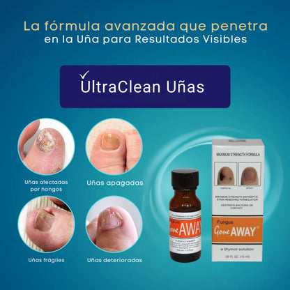 Tratamiento Antifúngico Pro – ¡Recupera la Salud y Belleza de tus Uñas Ya!