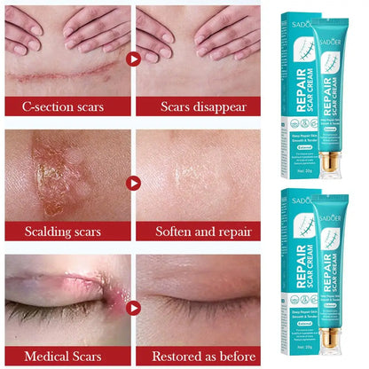 1/3/5/10pcs Scar Repair Cream Repairing Scald Moisturizing Rejuvenating Hydrating Face Cream Women Facial Skin Care Products
