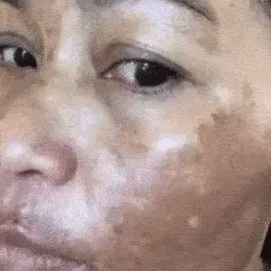 Crema Despigmentante Bioaqua – Aclarante de Manchas e Iluminador de Piel