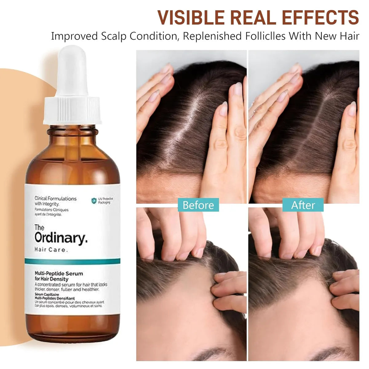 Serum Multi-Peptido The Ordinary – Densidad y Crecimiento para el Cabello